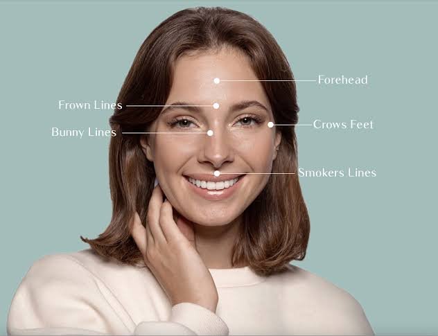 Botox Cosmetic